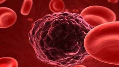 وزارة الصحة تنظم فاعليات توعوية ضد مرض السرطان