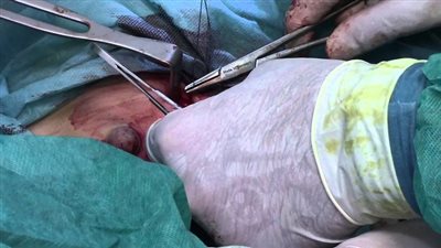 الداخلية: إجراء عملية جراحية لأحد الأطفال بمستشفى الشرطة بالإسكندرية