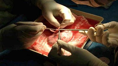 عرض ضحايا عصابة 