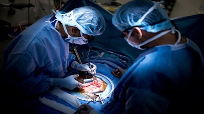 أستاذ جراحة: تجارة الأعضاء البشرية لن تتوقف