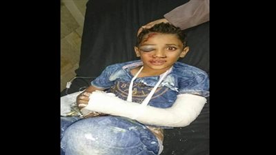 بالفيديو والصور.. لعبة 