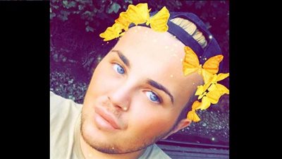 بالصور.. شاب يتحول إلى 