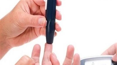 كشف مجاني على 200 فرد بأندية الإسكندرية