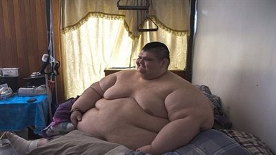 شاهد.. أسمن رجل في العالم يبدأ رحلة العلاج في المكسيك 