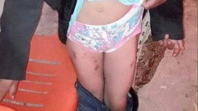 على طريقة ضحية البامبرز.. شاب يحاول التعدي جنسيًا على طفلة بالشرقية