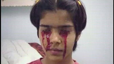 شاهد| فتاة تبكي دم.. هل مسها الجن؟