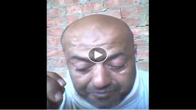 بالفيديو.. مصاب بالعمود الفقري يستغيث بالرئيس لإجراء عملية جراحية بمستشفيات الجيش