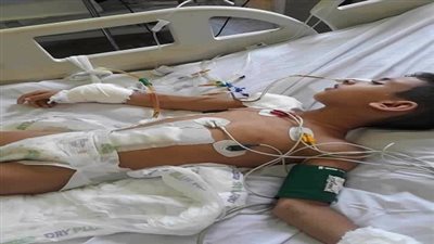 اصابة طفل بعجز دائم بسبب اهمال طبي بأحدى مستشفيات الدقهلية