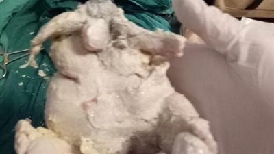 بالصور.. استخراج 