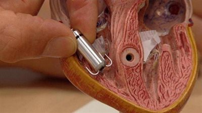 صدمة| الهاكرز يمكن أن يخترق جسدك ويقتلك 