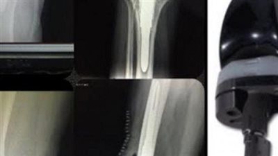 ضبط 608 قطعة مفصل أجنبى الصنع داخل إحدى شركات الإستيراد والتصدير 