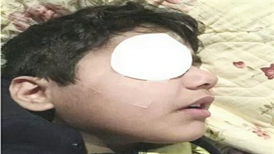 طالب يفقأ عين زميله بمدرسة ببنها