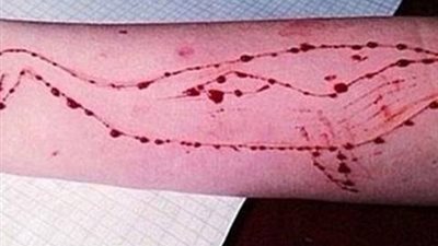 ناجي من لعبة الحوت الأزرق يروي تجربته.. ماذا قال؟