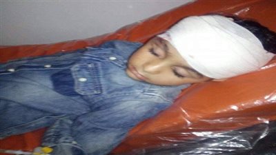 إصابة طفل بسبب اصطدامه بأحدى الالعاب داخل نادي بني عبيد دقهلية 