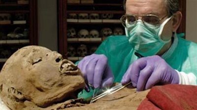 ديلي ميل: العثور على مومياوات لقدماء المصريين مصابة بالسرطان 