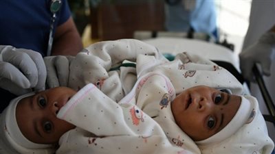 وصول التوأم التنزاني الملتصق إلى الرياض استعدادا لفصلهما