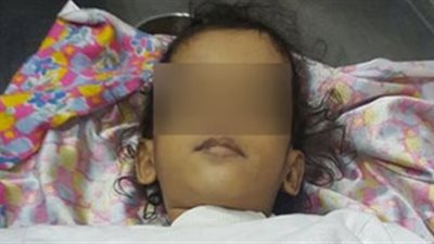 حادث بشع لطفلة في البحيرة.. هنا التفاصيل