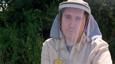 ظاهرة نادرة.. شاب قد يموت إذا تعرض لضوء الشمس