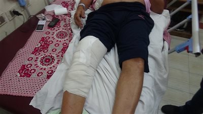 مدرس يعتدى بالضرب على مدير مدرسة بالسويس ويكسر قدمه