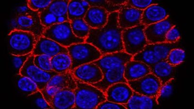 هل ظهرت على أحدكم؟.. علامة مميزة لظهور السرطان