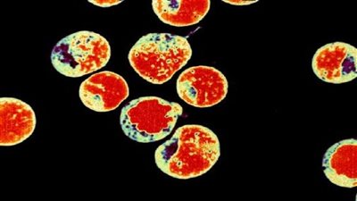 خطر يهدد بتدمير مناعة البشر.. إحترس منه