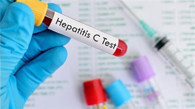 الصحة: فريق طبي مصري لمسح وعلاج فيروس سي في جنوب السودان