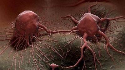 علاج السرطان في ألمانيا