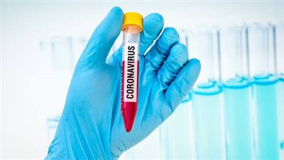 الأطباء توضح إجراءات مواجهة فيروس كورونا