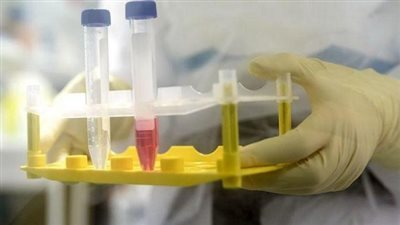 منظمة الصحة العالمية: تطعيم الدرن لا يقى من الإصابة بكورونا