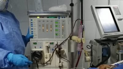 أول جلسة غسيل كلوي لحالة كورونا بالدقهلية