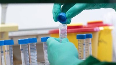 الصحة العالمية: لا ينصح باستخدام الكلوركوين في علاج كورونا