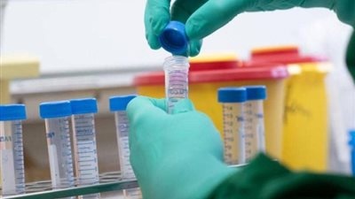 الصحة العالمية: 200 لقاح يخضع للمراحل النهائية لمكافحة كورونا