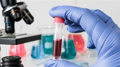 وزارة الصحة تعلن مراكز علاج الإيدز مجانا بالمحافظات