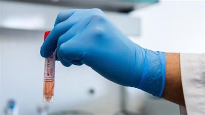 الحكومة الأوكرانية تمدد قيود فيروس كورونا لـ 30 أبريل المقبل