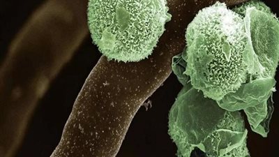 الصحة العراقية: لا يوجد أى خطورة من الفطر الأسود والأخضر