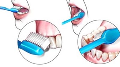 الصحة: السكريات والنشويات أكثر مسببات تسوس الأسنان