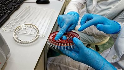 الصحة: 24 مركزا لعلاج المصابين بالإيدز فى 18 محافظة بالمجان