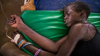 الملاريا تقتل 89 شخصا فى جنوب السودان