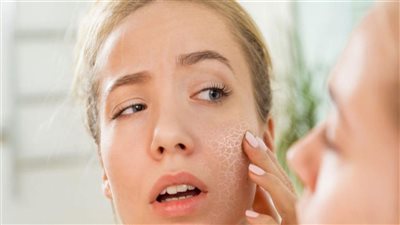 10 نصائح طبيعية لحماية البشرة الجافة خلال الشتاء 