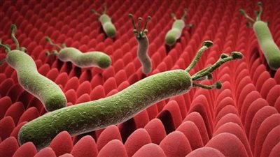 دكتور باطنة يكشف كيفية القضاء على جرثومة المعدة