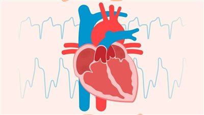 تكلفة استبدال الصمام الأبهري في الخارج: كيف تعرف الأسعار الحقيقية