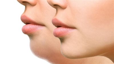 للسيدات فقط.. سبب ظهور الشعر في هذه المنطقة