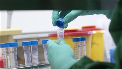 إحترس.. متحور كورونا الجديد EG.5 