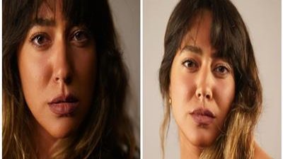 بعد إزالة حسنة من وجهها.. هند عبدالحليم: 