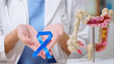الوقاية والعلاج لسرطان القولون والمستقيم في ألمانيا
