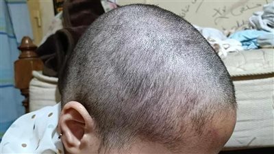 حلق شعرها.. كشف حقيقة ضرب فتاة من والدها وشقيقها