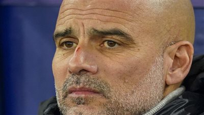 سر الجروح على وجه جوارديولا بعد تعادل مانشستر سيتي أمام فينورد