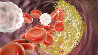 فاكهة لذيذة تحارب الكوليسترول الضار وتدعم صحة القلب