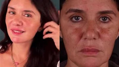 غادة عادل تفاجئ جمهورها بعملية «شد وجه».. وتعلق: رجعت 15 سنة ورا