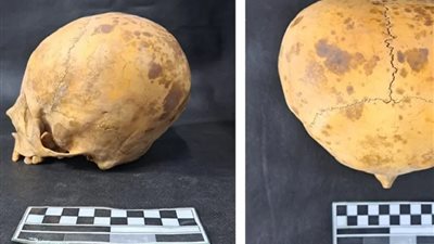 علماء يحلون لغز جمجمة 